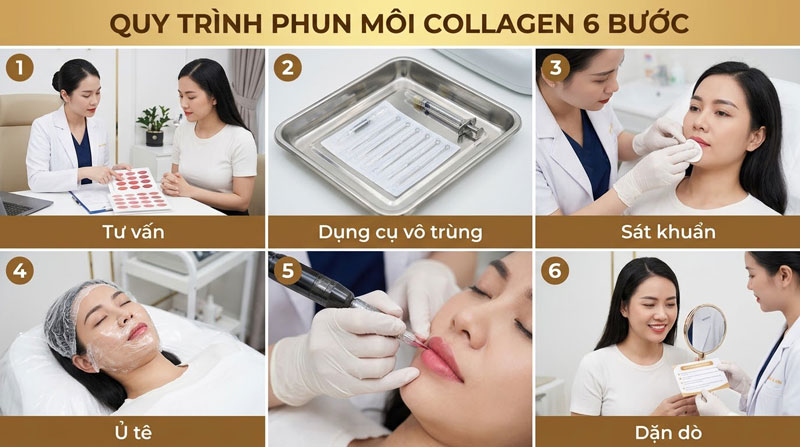 Quy tr&igrave;nh phun m&ocirc;i collagen tại Nhung Spa Th&aacute;i Nguy&ecirc;n